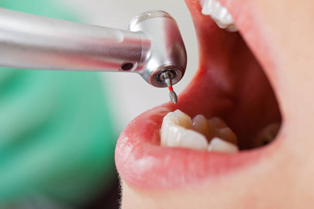 Best Walk-In Emergency Dental Services in Highland City, FL